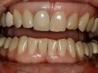 Konig Center for Cosmetic & Comprehensive Dentistry smile photos